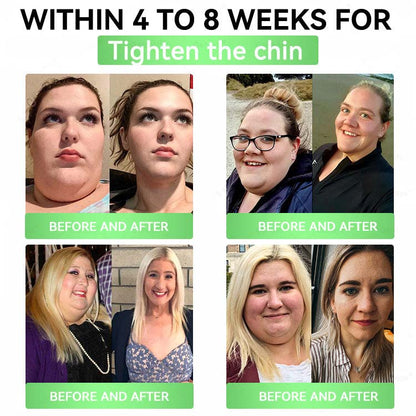 Slimming & Metabolic Nano Microneedle Patch - Visible changes in 7 days
