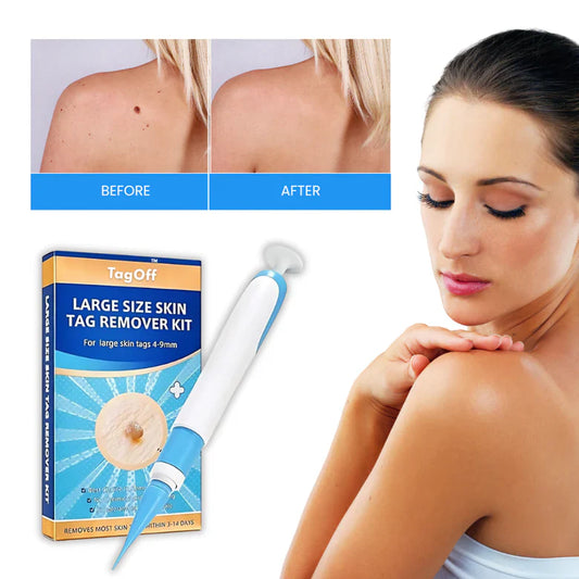 ✨ DermaErase™ Rapid Skin Tag Remover