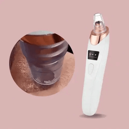Blackhead Remover Vacuum | Deep Pore Cleanser | Adjustable Suction | Rechargeable | PureLure