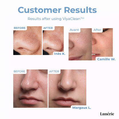 SkinClear™ Skin Renewal Therapy